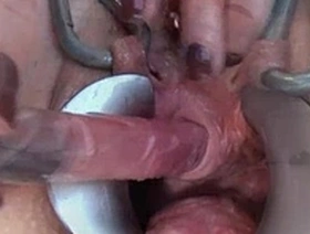 Bizarre sexual insertions: Fisting and giant dildos