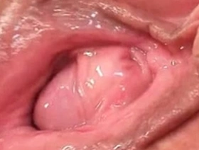 Linda's mature and hairy redheaded grandma in speculum sex